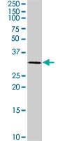 PAB0436 - CDK1