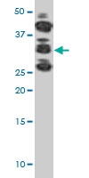 PAB0436 - CDK1