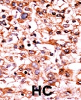 PAB0436 - CDK1