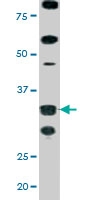 PAB0438 - CDK2