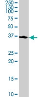 PAB0439 - CDK7