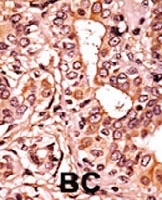 PAB0439 - CDK7