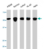 PAB0440 - CHK1