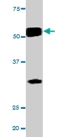PAB0440 - CHK1