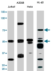 PAB0441 - CHK1