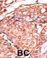PAB0443 - AP-1 / c-Jun