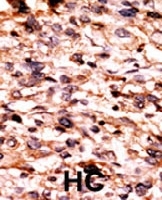 PAB0445 - CREB1