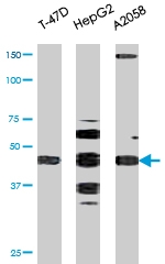 PAB0449 - E2F1