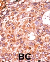 PAB0449 - E2F1