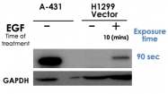 PAB0455 - EGFR / ERBB1