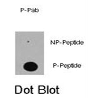 PAB0461 - EP300 / P300