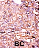PAB0461 - EP300 / P300