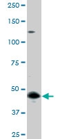 PAB0479 - GSK3 beta