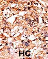PAB0479 - GSK3 beta