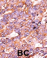 PAB0481 - Histone H3.1