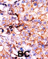 PAB0482 - Histone H3.1