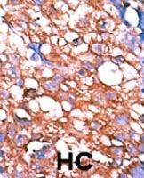 PAB0486 - ERBB4 / HER4
