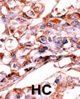 PAB0487 - ERBB4 / HER4