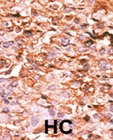 PAB0488 - Histone H3.1