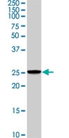 PAB0490 - HSPB1 / HSP27
