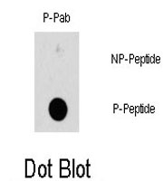PAB0490 - HSPB1 / HSP27