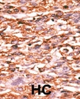 PAB0505 - CD309 / VEGFR-2 / Flk-1