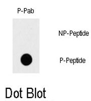 PAB0516 - TAK1 / MAP3K7