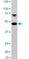 PAB0520 - MAPKAP Kinase-5