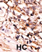 PAB0520 - MAPKAP Kinase-5