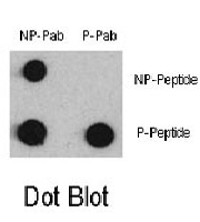 PAB0524 - MEF2C