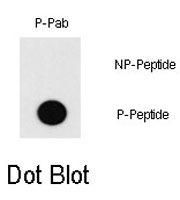 PAB0527 - MEF2C