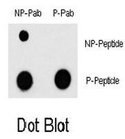 PAB0528 - MEF2C