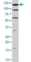 PAB0535 - HGF receptor