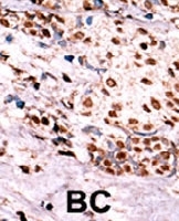 PAB0535 - HGF receptor