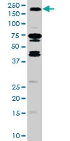 PAB0536 - HGF receptor