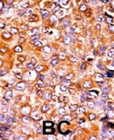 PAB0542 - PKMYT1