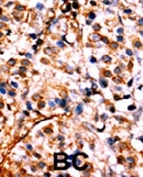 PAB0546 - RELA / NF-kB p65