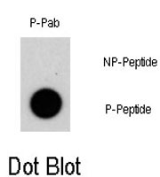 PAB0547 - NAK1