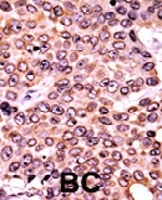 PAB0555 - CDKN1A / p21WAF1