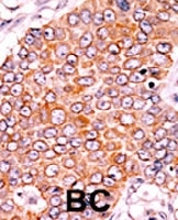 PAB0557 - CDKN1B / KIP1