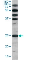 PAB0558 - CDKN1B / KIP1