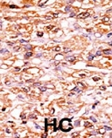 PAB0558 - CDKN1B / KIP1