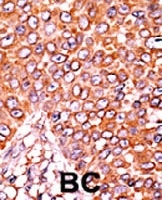 PAB0559 - CDKN1B / KIP1