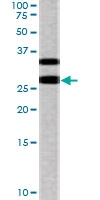PAB0560 - CDKN1B / KIP1
