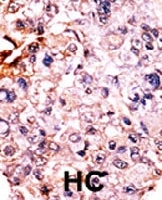 PAB0560 - CDKN1B / KIP1