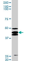 PAB0561 - TP53 / p53