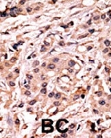 PAB0561 - TP53 / p53