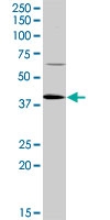 PAB0562 - TP53 / p53