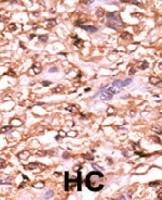 PAB0568 - TP53 / p53