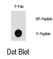 PAB0569 - PAK1